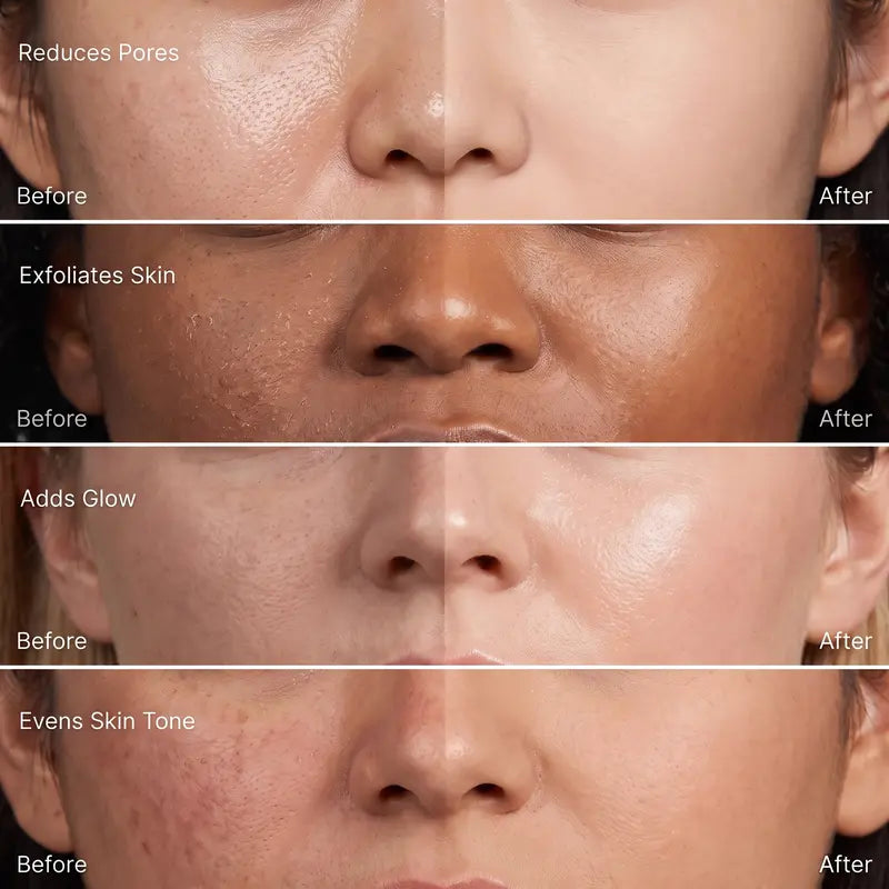 Apparent. Korean Toner Pads | Pore Refining, Exfoliating, Hydrating Pads for Face | AHA BHA & Niacinamide, Hyaluronic Acid | Brightening & Anti-Aging | 60 Pads 3.88 Oz.